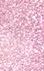 Heart Galaxy